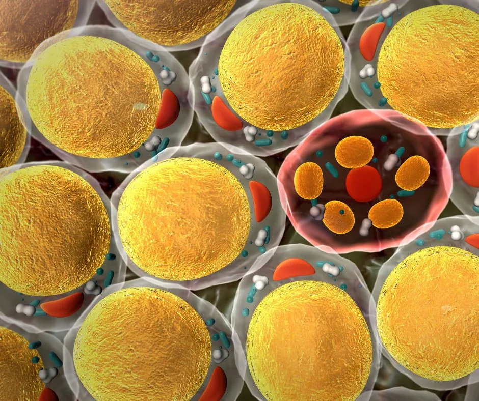 Scientific Fat Cells pre Cavitation | The Aesthetic Surgery | Weight Loss Cavitation
