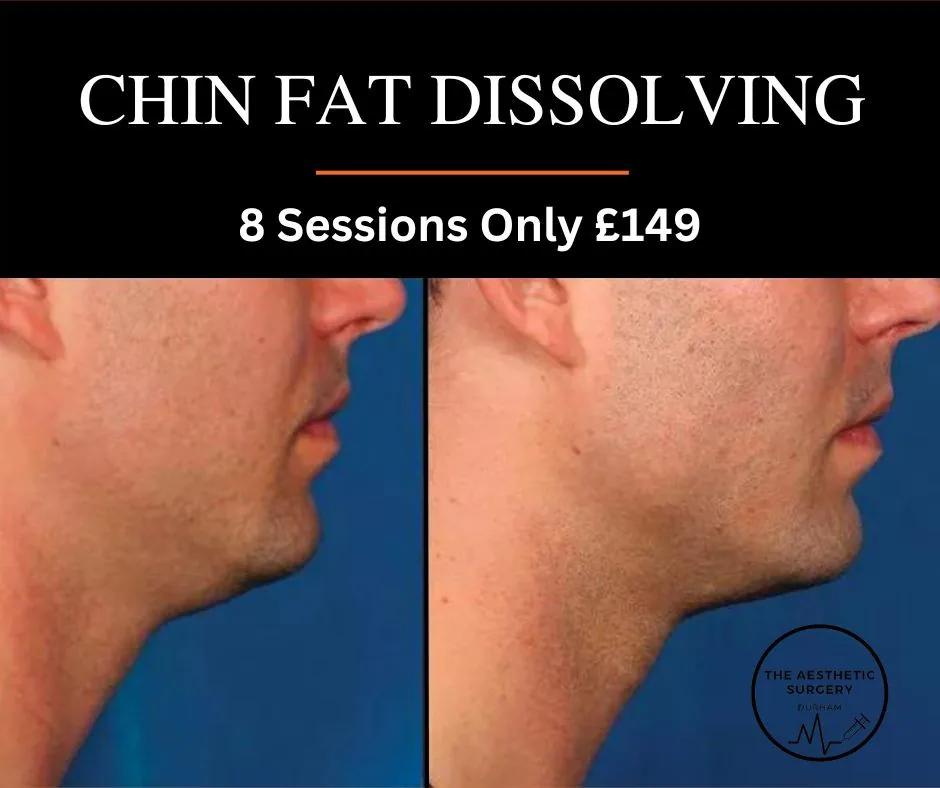 Male after fat dissolving in chin
