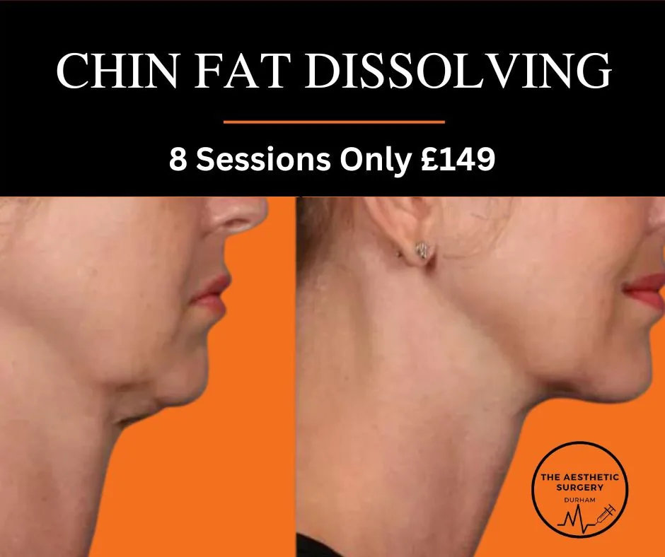 Female before and after fat dissolving